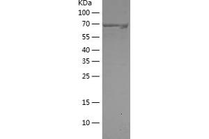 Western Blotting (WB) image for Itchy E3 Ubiquitin Protein Ligase Homolog (ITCH) (AA 197-542) protein (His-IF2DI Tag) (ABIN7123643) (ITCH Protein (AA 197-542) (His-IF2DI Tag))