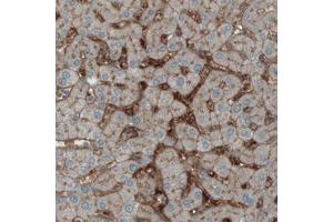 Immunohistochemical staining (Formalin-fixed paraffin-embedded sections) of human liver with ITIH4 monoclonal antibody, clone CL1858  shows immunoreactivity in sinusoids. (ITIH4 抗体)