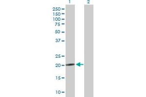 Western Blot analysis of NRSN2 expression in transfected 293T cell line by NRSN2 MaxPab polyclonal antibody. (NRSN2 抗体  (AA 1-204))