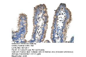 Rabbit Anti-RHOBTB1 Antibody  Paraffin Embedded Tissue: Human Intestine Cellular Data: Epithelial cells of intestinal villas Antibody Concentration: 4. (RHOBTB1 抗体  (Middle Region))