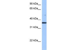 WB Suggested Anti-FAM153B Antibody Titration: 0. (FAM153B 抗体  (Middle Region))