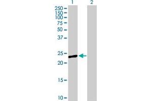 Western Blot analysis of PRTFDC1 expression in transfected 293T cell line by PRTFDC1 MaxPab polyclonal antibody. (PRTFDC1 抗体  (AA 1-225))