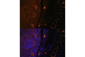 Immunofluorescence analysis of rat oophoroma cells using ZP3 antibody (ABIN6130818, ABIN6150537, ABIN6150539 and ABIN6224382) at dilution of 1:100. (Zona Pellucida Glycoprotein 3 抗体  (AA 170-390))