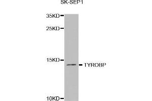 Western Blotting (WB) image for anti-TYRO Protein tyrosine Kinase Binding Protein (TYROBP) antibody (ABIN1876573) (TYROBP 抗体)