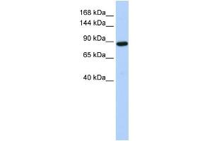 WB Suggested Anti-HACE1 Antibody Titration:  0. (HACE1 抗体  (Middle Region))
