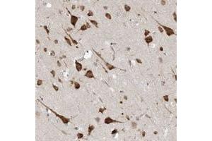 Immunohistochemical staining of human cerebral cortex with UBAP2L polyclonal antibody  shows strong cytoplasmic positivity in neuronal cells.