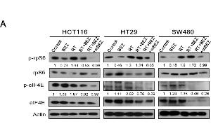 BEZ235 maintenance treatment following RT + BEZ235 treatment sensitized CRC cells to radiation by attenuating mTOR signaling- and angiogenesis-associated molecules. (Actin, gamma 1 抗体  (N-Term))