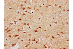 IHC image of ABIN7150950 diluted at 1:300 and staining in paraffin-embedded human brain tissue performed on a Leica BondTM system. (CBX4 抗体  (AA 1-160))