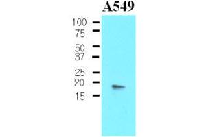 Western Blotting (WB) image for anti-Protein Phosphatase 1, Regulatory (Inhibitor) Subunit 14A (PPP1R14A) (AA 1-147), (N-Term) antibody (ABIN302213)