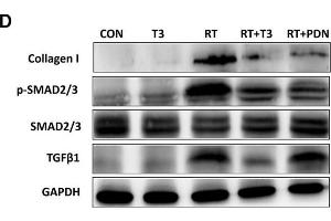 Increased DIO2 expression in lung tissue after radiation treatment and inhibition of the TGF-β1 signaling pathway by thyroid hormone. (GAPDH 抗体)