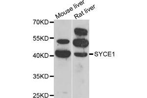 Western blot analysis of extracts of various cell lines, using SYCE1 antibody (ABIN5974347) at 1/1000 dilution.