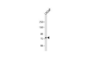 Anti-PFKL Ctr Antibody at 1:1000 dilution + LNCaP whole cell lysate Lysates/proteins at 20 μg per lane. (PFKL 抗体  (AA 371-399))