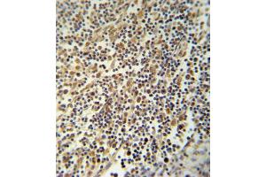 NLRP3 Antibody (N-term) (ABIN652504 and ABIN2842339) immunohistochemistry analysis in formalin fixed and paraffin embedded human lymph tissue followed by peroxidase conjugation of the secondary antibody and DAB staining. (NLRP3 抗体  (N-Term))