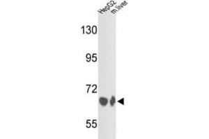Western Blotting (WB) image for anti-Complement Factor B (CFB) antibody (ABIN3003162) (Complement Factor B 抗体)
