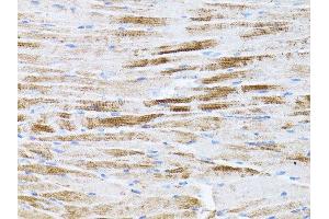 Immunohistochemistry (Paraffin-embedded Sections) (IHC (p)) image for anti-Actin, beta (ACTB) antibody (ABIN3020544)