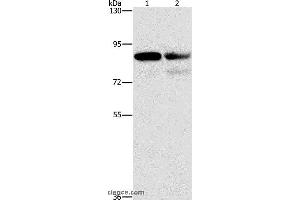 Western blot analysis of A431 and Raji cell, using CD2AP Polyclonal Antibody at dilution of 1:1000 (CD2AP 抗体)