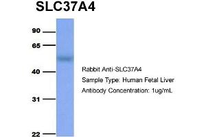 Western Blotting (WB) image for anti-Solute Carrier Family 37 (Glucose-6-Phosphate Transporter), Member 4 (SLC37A4) (Middle Region) antibody (ABIN2781570)