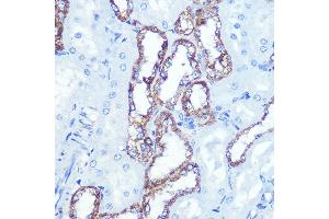 Immunohistochemistry (IHC) image for anti-Hexokinase 1 (HK1) antibody (ABIN7267638)
