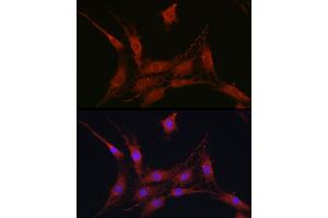 Immunofluorescence analysis of C6 cells using SLC4 / NBC Rabbit pAb (ABIN6129130, ABIN6148013, ABIN6148014 and ABIN6220962) at dilution of 1:100 (40x lens). (SLC4A4 抗体  (AA 1-240))