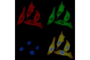 Hsp90 alpha Mouse Monoclonal Antibody staining Hela cells by IF/ICC.