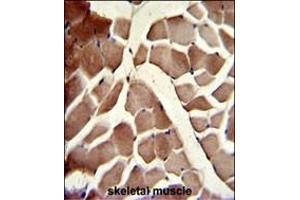 Immunohistochemistry (Paraffin-embedded Sections) (IHC (p)) image for anti-Component of Oligomeric Golgi Complex 4 (COG4) (AA 757-785), (C-Term) antibody (ABIN391631)