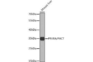Western blot analysis of extracts of mouse liver, using PRKRA/PACT antibody (ABIN6130639, ABIN6146220, ABIN6146221 and ABIN6221069) at 1:1000 dilution. (PRKRA 抗体  (AA 1-313))