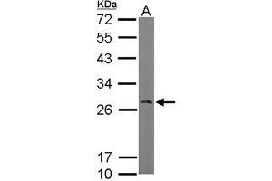 AP19035PU-N Ran BP1 antibody staining of Mouse brain (A) whole cell lysate (50 µg) at 1/1000 dilution, 12% SDS PAGE. (RANBP1 抗体  (N-Term))