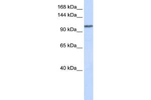 WB Suggested Anti-WDR63 Antibody Titration: 0. (WDR63 抗体  (Middle Region))