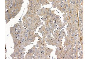 ABIN6259419 and ABIN6276193 at 1/100 staining rat brain tissue by IHC-P.