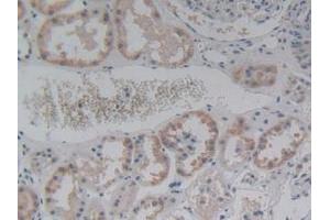 IHC-P analysis of Human Kidney Tissue, with DAB staining. (ABCC8 抗体  (AA 679-929))