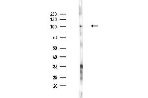 Western blot analysis of lysates from PC12 cells(UV,30 min treatment), using KCNQ2 Antibody at 1/1000 dilution.