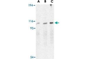 Western blot analysis of ERN1 in A-20 cell lysate with ERN1 polyclonal antibody  at (A) 0. (ERN1 抗体  (C-Term))