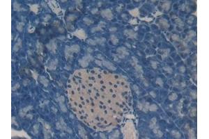 Immunohistochemistry (IHC) image for anti-Oncomodulin (OCM) (AA 1-109) antibody (ABIN7439579)
