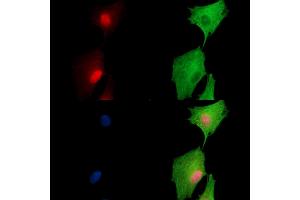 ABIN7097004 and ABIN7101071 staining  cells by IF/ICC. (ARIP4 抗体)