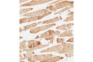 Immunohistochemical analysis of paraffin-embedded human skeletal muscle tissue using (ABIN656548 and ABIN2845810) performed on the Leica® BOND RXm. (KERA 抗体  (C-Term))