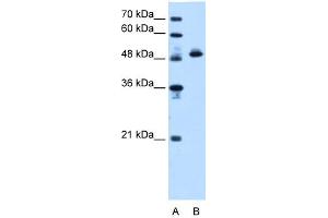 Western Blotting (WB) image for anti-ATP Synthase, H+ Transporting, Mitochondrial F1 Complex, beta Polypeptide (ATP5B) (N-Term) antibody (ABIN2783268)