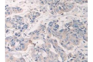 Immunohistochemistry (IHC) image for anti-Solute Carrier Family 12 (Sodium/Chloride Transporters), Member 3 (SLC12A3) (AA 867-1024) antibody (ABIN7441745)