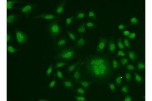 Immunofluorescence analysis of HeLa cells using ERCC1 antibody (ABIN5973037).
