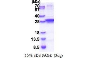 SDS-PAGE (SDS) image for Uracil-DNA Glycosylase (UNG) (AA 1-229) protein (His tag) (ABIN5853288) (UNG Protein (AA 1-229) (His tag))