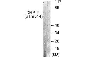 Immunohistochemistry analysis of paraffin-embedded human brain tissue using DRP-2 (Phospho-Thr514) antibody. (DRP2 抗体  (pThr514))