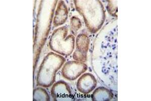Immunohistochemistry (Paraffin-embedded Sections) (IHC (p)) image for anti-C-Type Lectin Domain Family 3, Member B (CLEC3B) (AA 102-130), (Middle Region) antibody (ABIN951566)