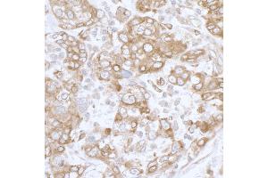 anti-Progesterone Receptor Membrane Component 1 (PGRMC1) (AA 145-195) antibody