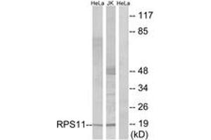 Western blot analysis of extracts from HeLa/Jurkat cells, using RPS11 Antibody. (RPS11 抗体  (AA 71-120))