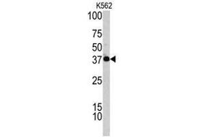 Image no. 1 for anti-Complement Factor H-Related 1 (CFHR1) (C-Term) antibody (ABIN452839) (CFHR1 抗体  (C-Term))