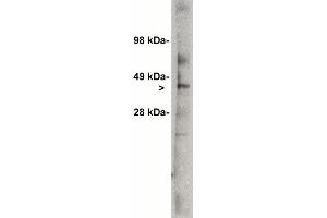 Western blot analysis using Ceramide Glycosyltransferase antibody (X1700P) on 7 ug  of rat kidney lysate. (UGCG 抗体)