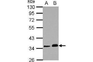 WB Image Sample (30 ug of whole cell lysate) A: A431 B: HeLa 10% SDS PAGE antibody diluted at 1:1000 (PPM1J 抗体)