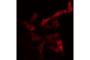 Immunofluorescence (fixed cells) (IF/ICC) image for anti-Cytochrome P450, Family 2, Subfamily C, Polypeptide 19 (CYP2C19) (C-Term) antibody (ABIN6261197)