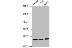 Western Blot Positive WB detected in: Mouse brain tissue, Rat liver tissue, Rat lung tissue All lanes: Histone H2B type 1-K antibody at 0. (Recombinant HIST1H2BK 抗体)