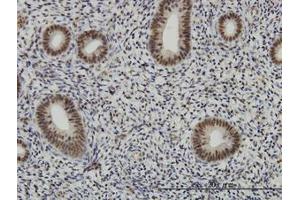 Image no. 2 for anti-AF4/FMR2 Family, Member 4 (AFF4) (AA 1-109) antibody (ABIN466197) (AFF4 抗体  (AA 1-109))