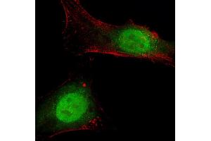 Immunofluorescent analysis of 4 % paraformaldehyde-fixed, 0. (BAP1 抗体  (AA 36-66))